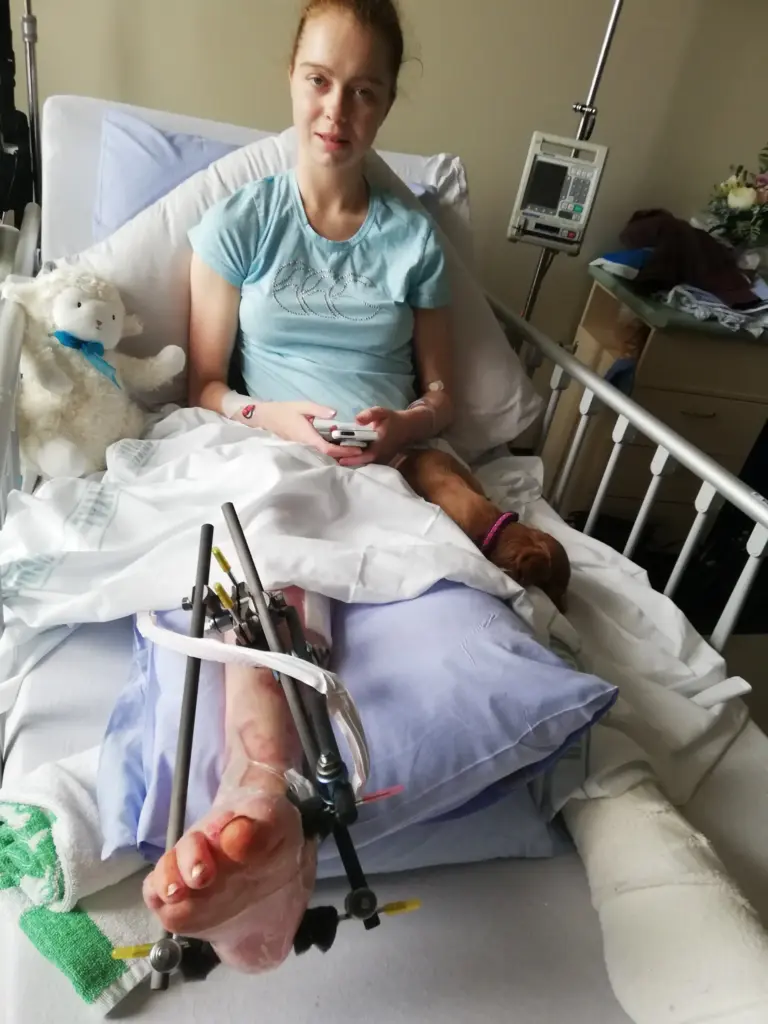 Leg+saving+surgery+and+pins