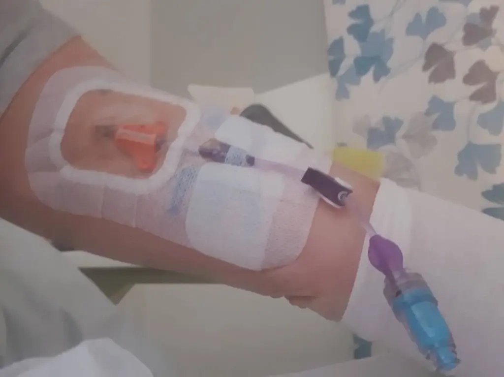 Arm+shot+close+up